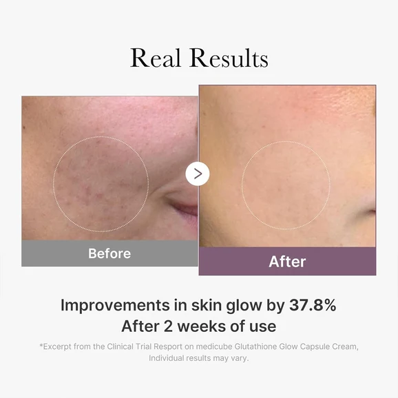 Medicube AGE-R Glutathione Glow Capsule Cream 50ml product photo