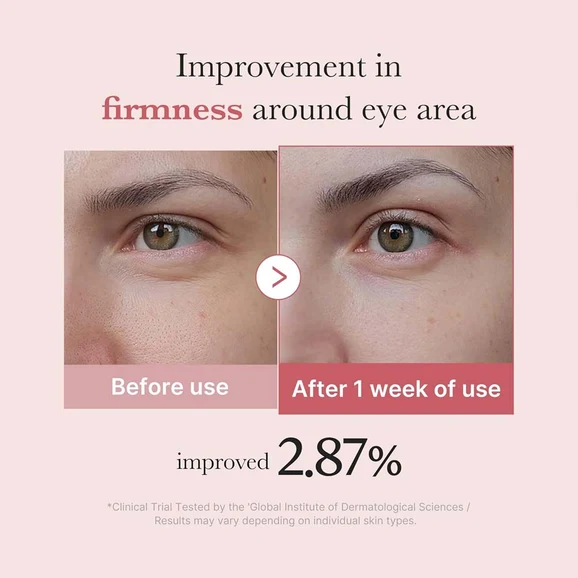 Medicube PDRN Pink Peptide Eye Cream 30ml product photo