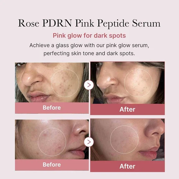 Medicube PDRN Pink Peptide Serum 30ml product photo