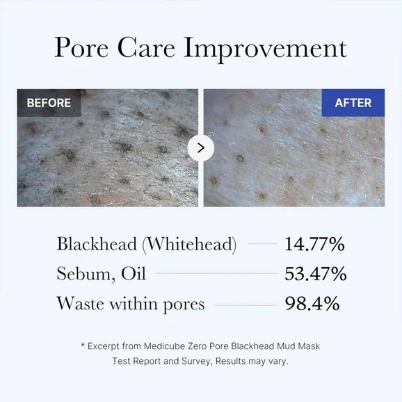 Medicube Zero Pore Blackhead Mud Mask 100ml product photo