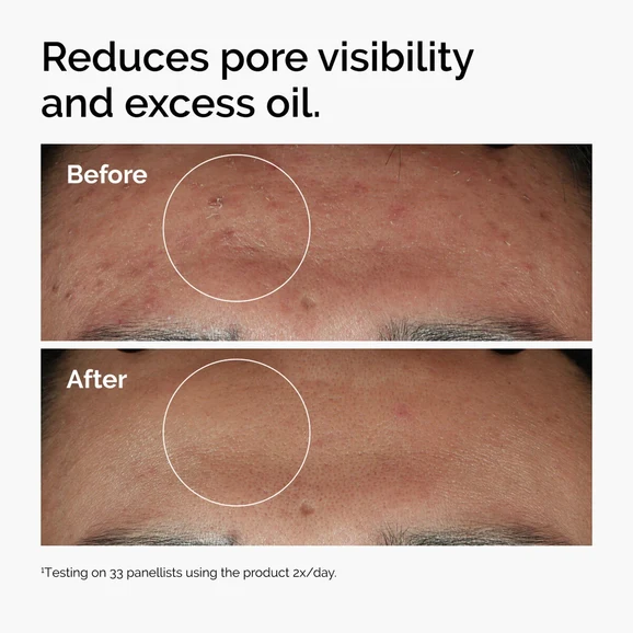 The Ordinary Niacinamide 10% + Zinc 1% 30ml product photo