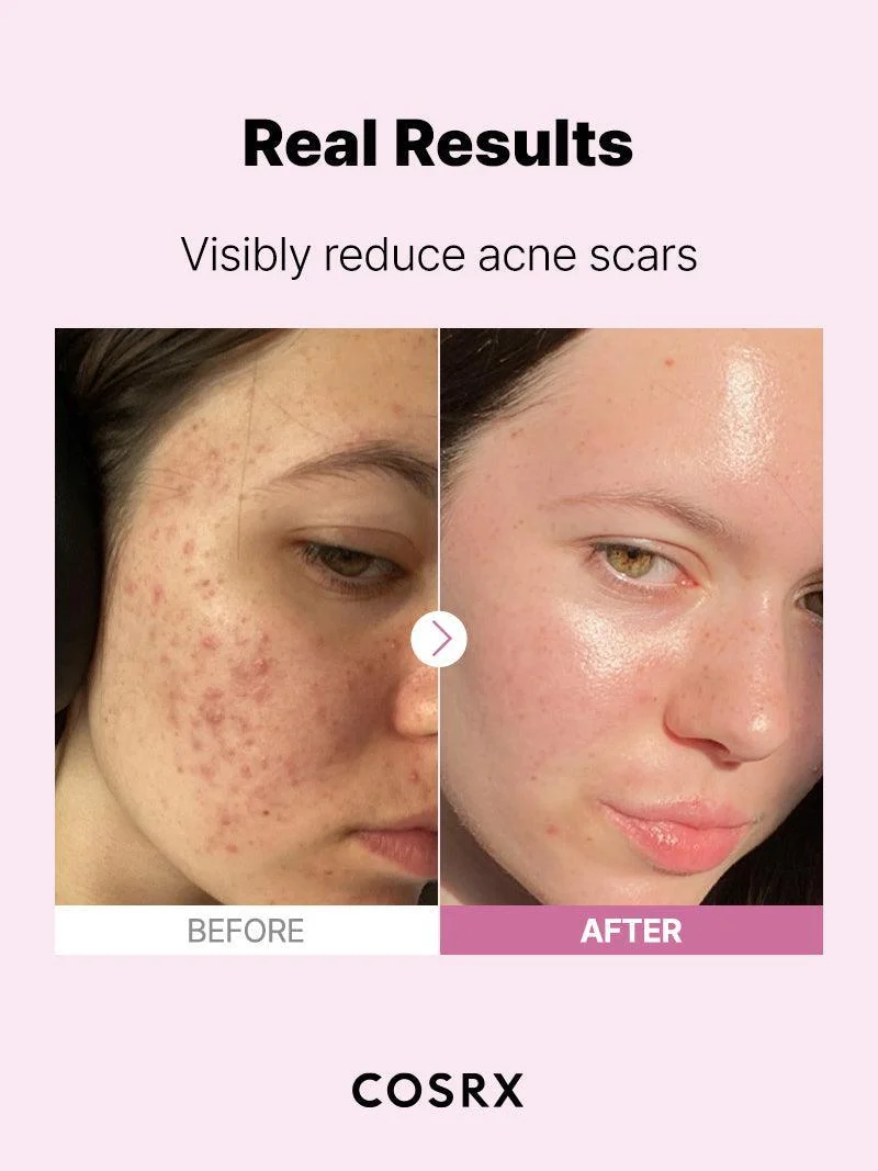 COSRX The Niacinamide 15 Serum 20ml product photo